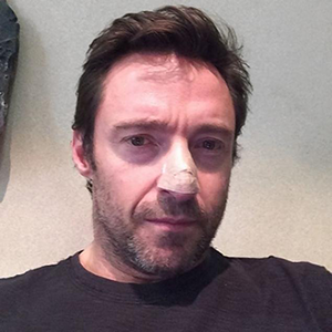 Hugh Jackman Basal Cell Carcinoma